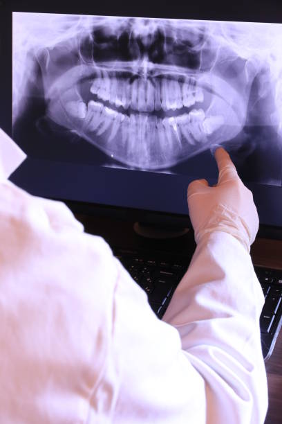 Best Emergency Dental Care for Broken or Chipped Teeth in Bostonia, CA